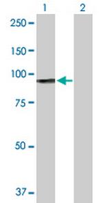 H6PD Polyclonal Antibody, MaxPab™