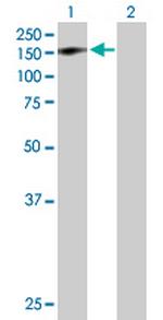 GTF2IRD1 Antibody in Western Blot (WB)