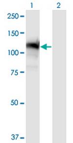 GTF2IRD1 Monoclonal Antibody (2C7)