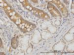 CDC42BPB Antibody in Immunohistochemistry (Paraffin) (IHC (P))