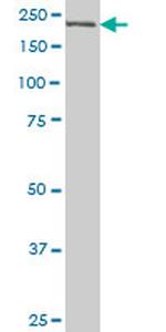 CDC42BPB Antibody in Western Blot (WB)