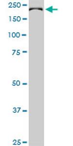 CDC42BPB Antibody in Western Blot (WB)