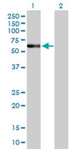 ENTPD4 Polyclonal Antibody, MaxPab™