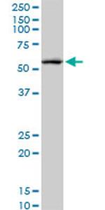 CREB5 Antibody in Western Blot (WB)