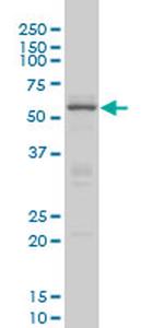 CREB5 Antibody in Western Blot (WB)