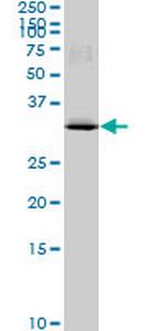 MAD2L1BP Monoclonal Antibody (4G11)