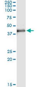 MAD2L1BP Monoclonal Antibody (4B9)