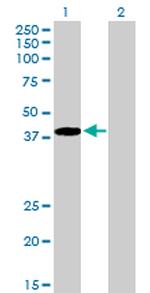 RNF14 Antibody in Western Blot (WB)