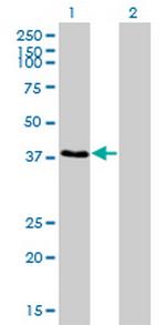 RNF14 Antibody in Western Blot (WB)