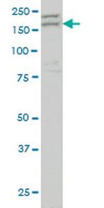AATK Antibody in Western Blot (WB)