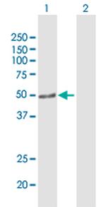 ARHGEF10 Antibody in Western Blot (WB)