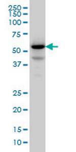PPM1F Monoclonal Antibody (2A9)