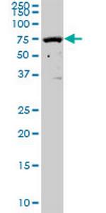 SOCS5 Polyclonal Antibody, MaxPab™