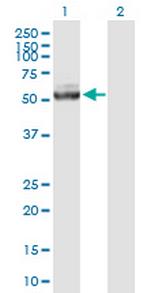IQCB1 Antibody in Western Blot (WB)