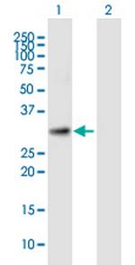 KIAA0103 Polyclonal Antibody, MaxPab™