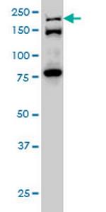 ESPL1 Monoclonal Antibody (6H6)