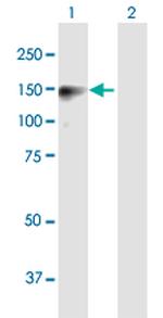 SAPS2 Polyclonal Antibody, MaxPab™