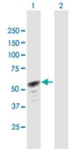 HERPUD1 Polyclonal Antibody, MaxPab™