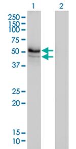 HERPUD1 Monoclonal Antibody (3E10)