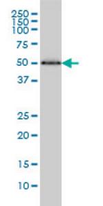 HERPUD1 Monoclonal Antibody (2G7)