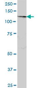 SART3 Antibody in Western Blot (WB)