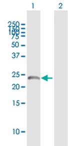SART3 Antibody in Western Blot (WB)