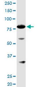 ACAP1 Antibody in Western Blot (WB)