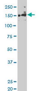 SLK Antibody in Western Blot (WB)