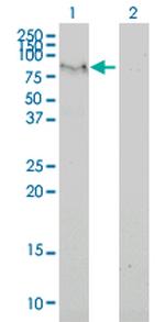 C6ORF32 Monoclonal Antibody (2F6-1A11)