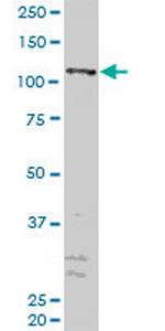 ZFYVE16 Monoclonal Antibody (2E2)