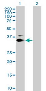 KIAA0247 Antibody in Western Blot (WB)