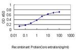 KIAA0101 Antibody in ELISA (ELISA)