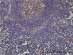 KIAA0101 Antibody in Immunohistochemistry (Paraffin) (IHC (P))
