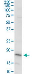 DAZAP2 Monoclonal Antibody (8G5)