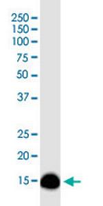 TOMM20 Antibody in Western Blot (WB)