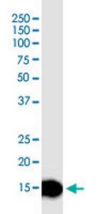 TOMM20 Antibody in Western Blot (WB)