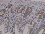 TOMM20 Antibody in Immunohistochemistry (Paraffin) (IHC (P))