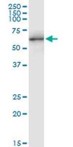 NUPL1 Antibody in Western Blot (WB)