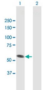 SPATA2 Antibody in Western Blot (WB)