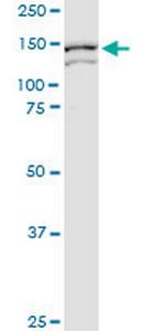 ARHGEF11 Antibody in Western Blot (WB)