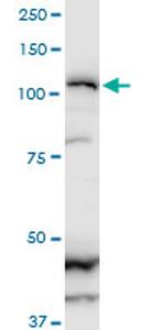 ZFHX1B Monoclonal Antibody (2H5)