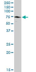 EPM2AIP1 Antibody in Western Blot (WB)