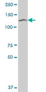 SETDB1 Antibody in Western Blot (WB)