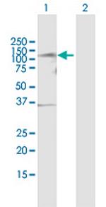 TLK1 Polyclonal Antibody, MaxPab™