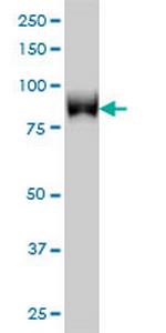TLK1 Monoclonal Antibody (4B3)