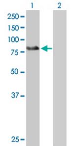 ZBTB39 Polyclonal Antibody, MaxPab™