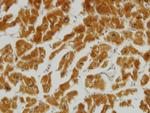 MFN2 Monoclonal Antibody (4H8)