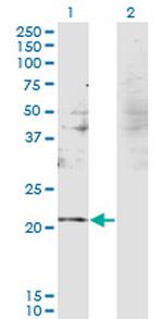 RBM8A Antibody in Western Blot (WB)