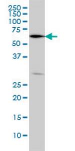 OXSR1 Monoclonal Antibody (5D5)