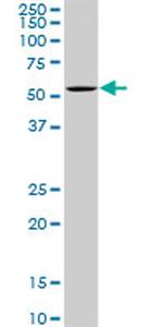OXSR1 Antibody in Western Blot (WB)